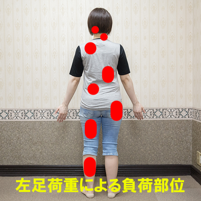 左足に重心をかけた場合に生じる身体の負荷を赤いマークで示した後ろ姿の女性
